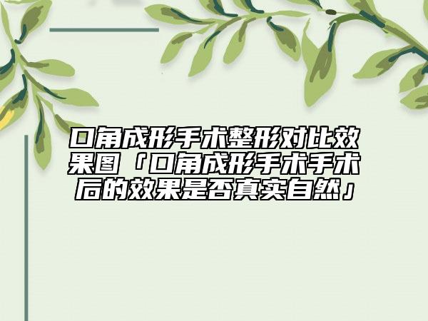 口角成形手术整形对比效果图「口角成形手术手术后的效果是否真实自然」