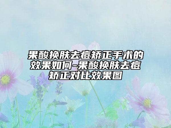 果酸换肤去痘矫正手术的效果如何-果酸换肤去痘矫正对比效果图