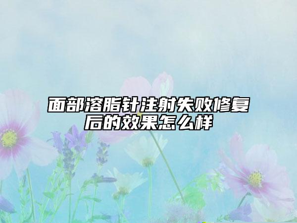 面部溶脂针注射失败修复后的效果怎么样