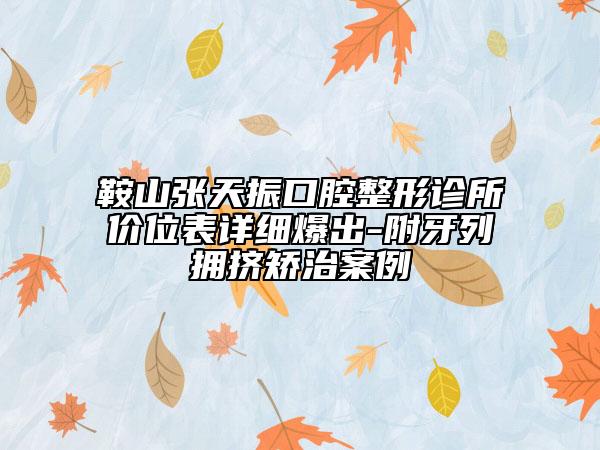 鞍山张天振口腔整形诊所价位表详细爆出-附牙列拥挤矫治案例