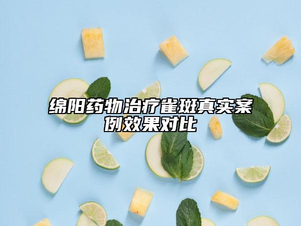绵阳药物治疗雀斑真实案例效果对比