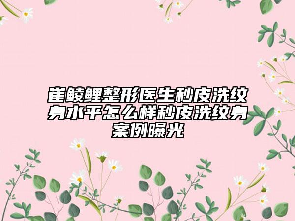 崔鲮鲤整形医生秒皮洗纹身水平怎么样秒皮洗纹身案例曝光