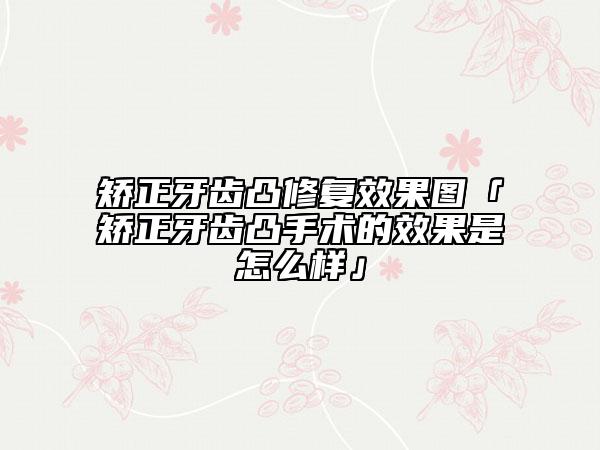 矫正牙齿凸修复效果图「矫正牙齿凸手术的效果是怎么样」