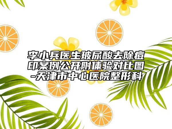李小兵医生玻尿酸去除痘印案例公开附体验对比图-天津市中心医院整形科