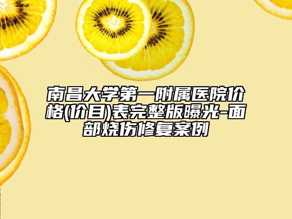 南昌大学第一附属医院价格(价目)表完整版曝光-面部烧伤修复案例
